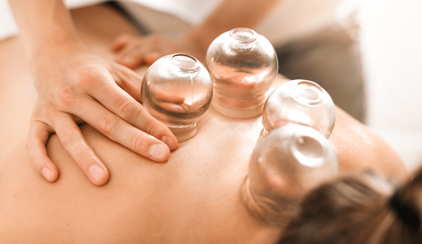 Cupping Therapy
