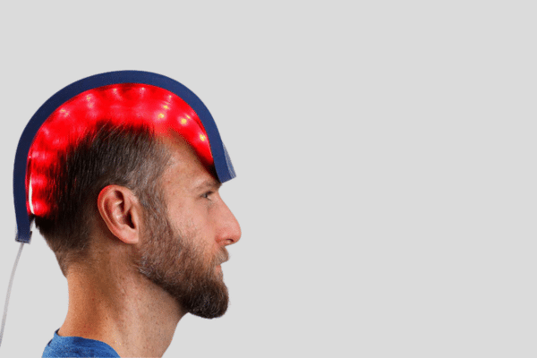 Celluma Treatment for Hairloss